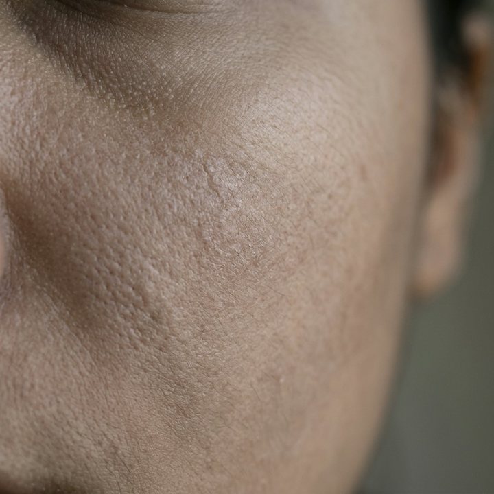 Close-up of luminous skin